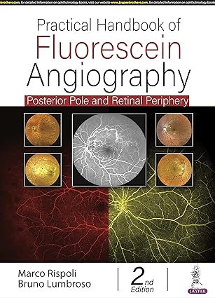 Practical Handbook of Fluorescein Angiography: Posterior Pole and Retinal Periphery 2nd Edition